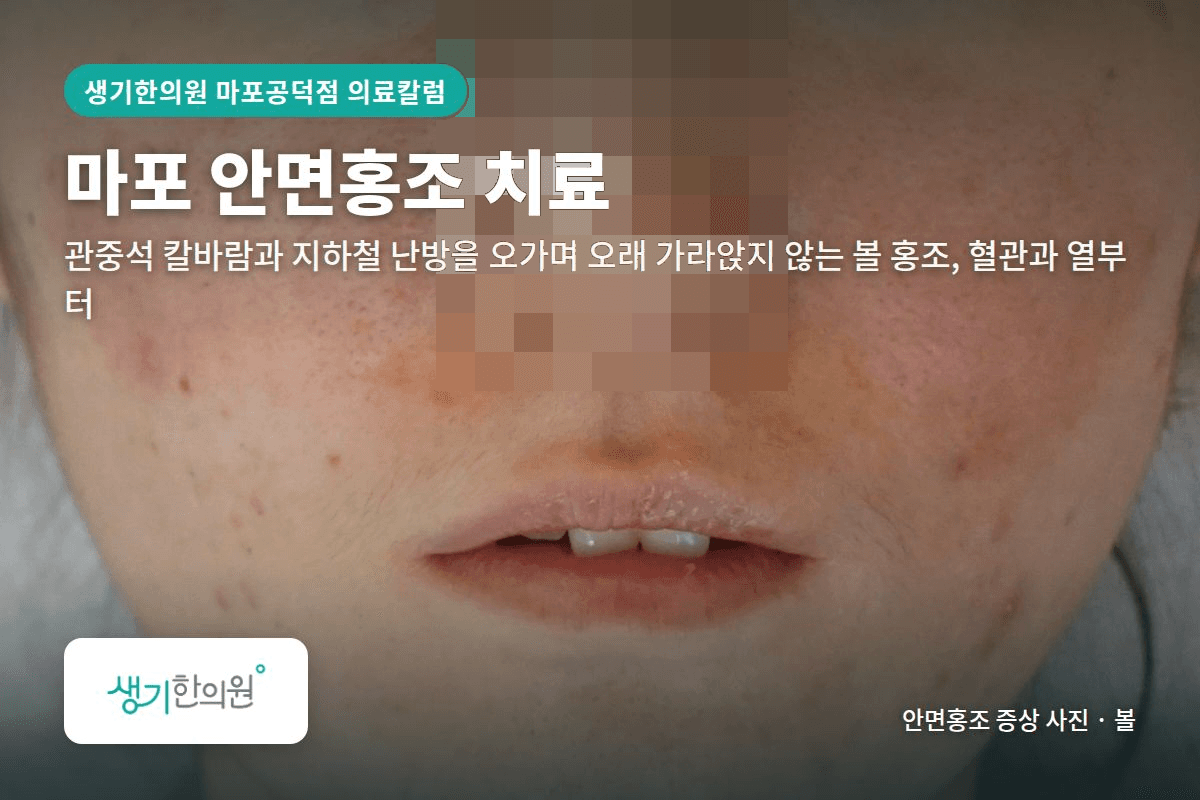 볼 안면홍조 증상 사진과 문구 「마포 안면홍조 치료, 관중석 칼바람과 지하철 난방을 오가며 오래 가라앉지 않는 볼 홍조, 혈관과 열부터 · 생기한의원 마포공덕점」